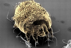 photolibrary_rf_photo_of_scabies_mite
