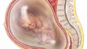 مایع آمنیوتیک یا آب دور جنین / کم یا زیاد شدن مایع آمنیوتیک چه تاثیری روی جنین دارد ؟