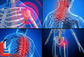 سندرم درد اسکلتی-عضلانی / فیبرومیالژی