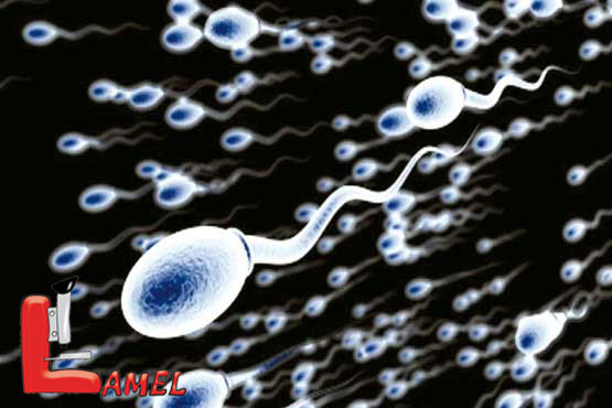 اسپرماتوسل (Spermatocele) چیست؟ /کیست سلول های نطفه ساز یا اسپرماتوسل