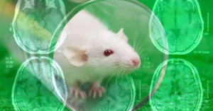 آلزایمر
